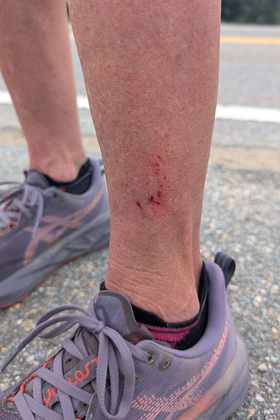 Lone Star Tick Bombing